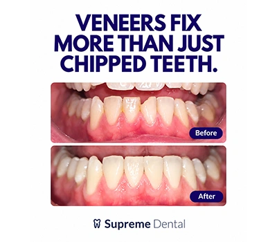 Supreme-Dental_Mobile-Banner_1-1