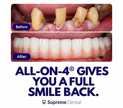 Supreme-Dental_Mobile-Banner_2-1